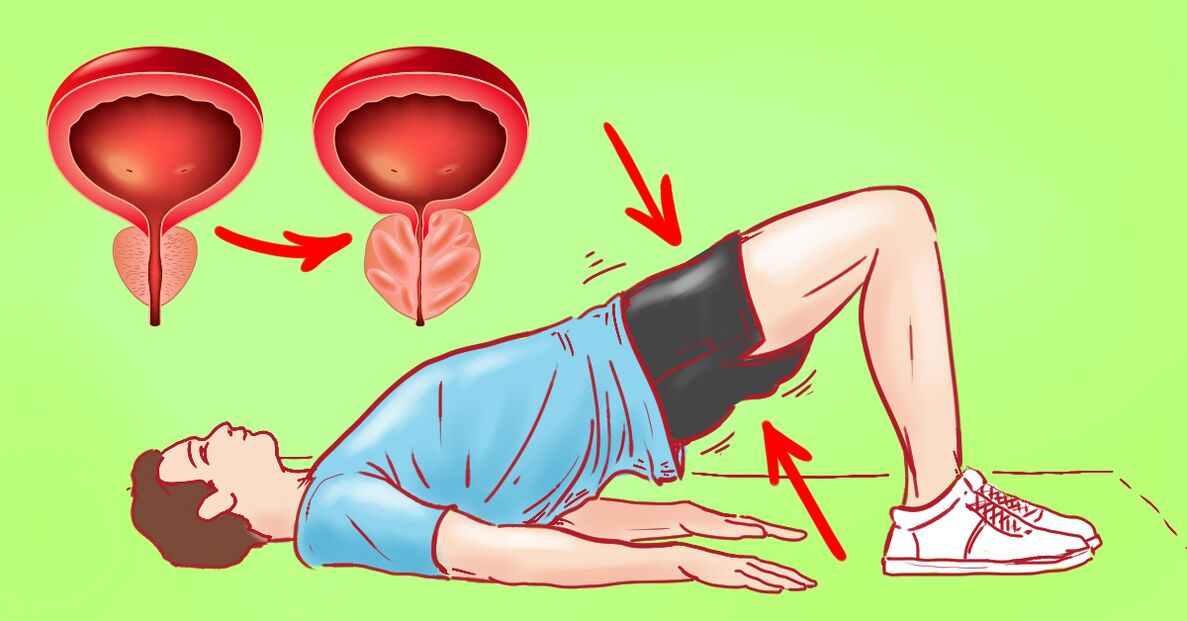 gymnastické cvičení pro prostatitidu